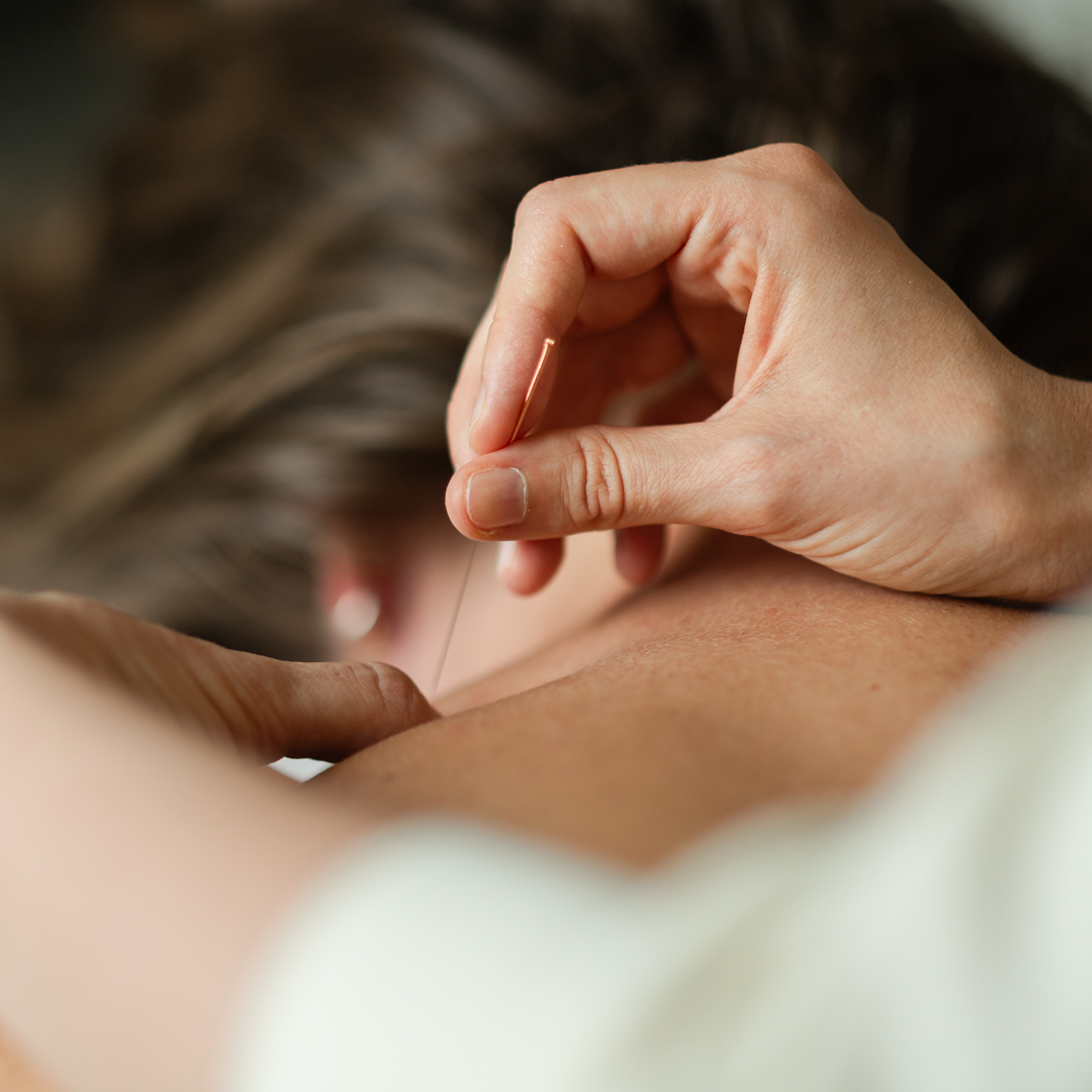 Kine Kamerijk 240803 SQ-50